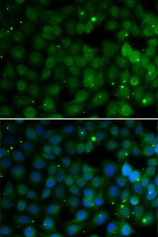 HPD Antibody - Immunofluorescence analysis of U20S cells.