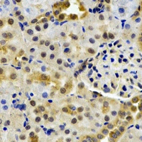 HPD Antibody - Immunohistochemical analysis of HPPDase staining in rat kidney formalin fixed paraffin embedded tissue section. The section was pre-treated using heat mediated antigen retrieval with sodium citrate buffer (pH 6.0). The section was then incubated with the antibody at room temperature and detected using an HRP conjugated compact polymer system. DAB was used as the chromogen. The section was then counterstained with hematoxylin and mounted with DPX.