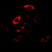HPD Antibody - Immunofluorescent analysis of HPPDase staining in U2OS cells. Formalin-fixed cells were permeabilized with 0.1% Triton X-100 in TBS for 5-10 minutes and blocked with 3% BSA-PBS for 30 minutes at room temperature. Cells were probed with the primary antibody in 3% BSA-PBS and incubated overnight at 4 deg C in a humidified chamber. Cells were washed with PBST and incubated with a DyLight 594-conjugated secondary antibody (red) in PBS at room temperature in the dark.