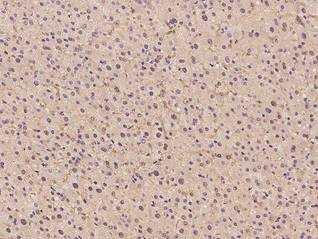 HPD Antibody - Immunochemical staining of human HPD in human liver with rabbit polyclonal antibody at 1:500 dilution, formalin-fixed paraffin embedded sections.