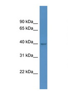 HPDL Antibody - HPDL antibody Western blot of 293T Cell lysate. Antibody concentration 1 ug/ml.  This image was taken for the unconjugated form of this product. Other forms have not been tested.