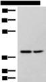 HPDL Antibody - Western blot analysis of Hela and 231 cell lysates  using HPDL Polyclonal Antibody at dilution of 1:400
