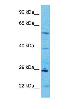 HPF1 Antibody - Western blot of C4orf27 Antibody with human HT1080 Whole Cell lysate.  This image was taken for the unconjugated form of this product. Other forms have not been tested.