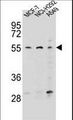 HPF9 / ZNF117 Antibody - ZNF117 Antibody western blot of MCF-7,NCI-H292,A549 cell line lysates (35 ug/lane). The ZNF117 antibody detected the ZNF117 protein (arrow).