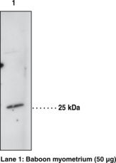 HPGDS Antibody - Western blot of HPGDS / PGDS antibody.