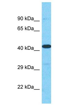 HPH2 / PHC2 Antibody - HPH2 / PHC2 antibody Western Blot of HT1080. Antibody dilution: 1 ug/ml.  This image was taken for the unconjugated form of this product. Other forms have not been tested.