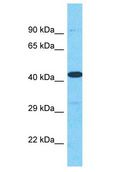 HPH2 / PHC2 Antibody - HPH2 / PHC2 antibody Western Blot of HT1080. Antibody dilution: 1 ug/ml.  This image was taken for the unconjugated form of this product. Other forms have not been tested.