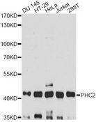 HPH2 / PHC2 Antibody - Western blot analysis of extracts of various cell lines, using PHC2 antibody at 1:3000 dilution. The secondary antibody used was an HRP Goat Anti-Rabbit IgG (H+L) at 1:10000 dilution. Lysates were loaded 25ug per lane and 3% nonfat dry milk in TBST was used for blocking. An ECL Kit was used for detection and the exposure time was 90s.