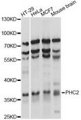HPH2 / PHC2 Antibody - Western blot analysis of extracts of various cell lines, using PHC2 antibody at 1:1000 dilution. The secondary antibody used was an HRP Goat Anti-Rabbit IgG (H+L) at 1:10000 dilution. Lysates were loaded 25ug per lane and 3% nonfat dry milk in TBST was used for blocking. An ECL Kit was used for detection and the exposure time was 5s.