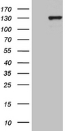 HPMS1 / PMS1 Antibody - HEK293T cells were transfected with the pCMV6-ENTRY control. (Left lane) or pCMV6-ENTRY PMS1. (Right lane) cDNA for 48 hrs and lysed. Equivalent amounts of cell lysates. (5 ug per lane) were separated by SDS-PAGE and immunoblotted with anti-PMS1. (1:2000)