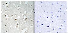 HPMS1 / PMS1 Antibody - Immunohistochemistry analysis of paraffin-embedded human brain, using PMS1 Antibody. The picture on the right is blocked with the synthesized peptide.