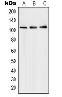 HPMS1 / PMS1 Antibody - Western blot analysis of PMS1 expression in HepG2 (A); Molt4 (B); A549 (C) whole cell lysates.