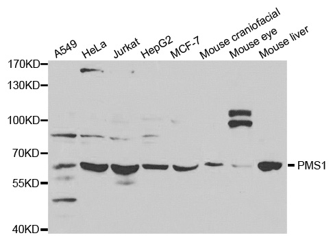 HPMS1 / PMS1 Antibody - Western blot analysis of extracts of various cell lines.