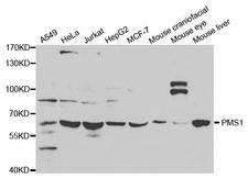 HPMS1 / PMS1 Antibody - Western blot analysis of extracts of various cell lines.