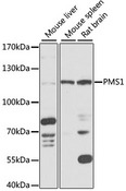 HPMS1 / PMS1 Antibody - Western blot analysis of extracts of various cell lines, using PMS1 antibody at 1:1000 dilution. The secondary antibody used was an HRP Goat Anti-Rabbit IgG (H+L) at 1:10000 dilution. Lysates were loaded 25ug per lane and 3% nonfat dry milk in TBST was used for blocking. An ECL Kit was used for detection and the exposure time was 5s.