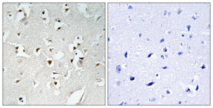 HPMS1 / PMS1 Antibody - Peptide - + Immunohistochemistry analysis of paraffin-embedded human brain tissue using PMS1 antibody.