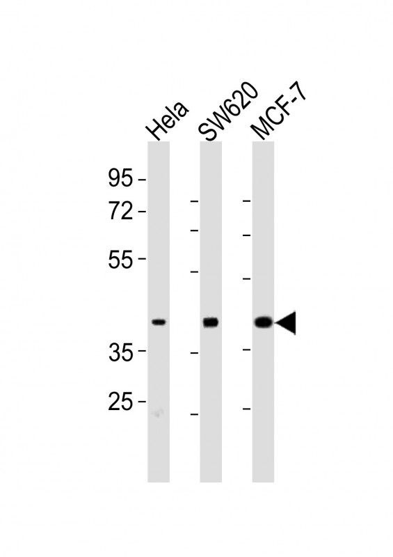HPN / TMPRSS1 / Hepsin Antibody - All lanes : Anti-HPN Antibody at 1:2000 dilution Lane 1: HeLa whole cell lysates Lane 2: SW620 whole cell lysates Lane 3: MCF-7 whole cell lysates Lysates/proteins at 20 ug per lane. Secondary Goat Anti-Rabbit IgG, (H+L), Peroxidase conjugated at 1/10000 dilution Predicted band size : 45 kDa Blocking/Dilution buffer: 5% NFDM/TBST.