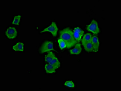 HPN / TMPRSS1 / Hepsin Antibody - Immunofluorescence staining of MCF-7 cells at a dilution of 1:133, counter-stained with DAPI. The cells were fixed in 4% formaldehyde, permeabilized using 0.2% Triton X-100 and blocked in 10% normal Goat Serum. The cells were then incubated with the antibody overnight at 4 °C.The secondary antibody was Alexa Fluor 488-congugated AffiniPure Goat Anti-Rabbit IgG (H+L) .