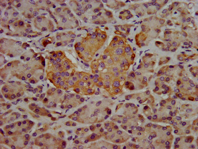 HPN / TMPRSS1 / Hepsin Antibody - Immunohistochemistry image at a dilution of 1:400 and staining in paraffin-embedded human pancreatic tissue performed on a Leica BondTM system. After dewaxing and hydration, antigen retrieval was mediated by high pressure in a citrate buffer (pH 6.0) . Section was blocked with 10% normal goat serum 30min at RT. Then primary antibody (1% BSA) was incubated at 4 °C overnight. The primary is detected by a biotinylated secondary antibody and visualized using an HRP conjugated SP system.