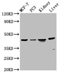 HPN / TMPRSS1 / Hepsin Antibody - Positive Western Blot detected in MCF-7 whole cell lysate, PC3 whole cell lysate, Rat kidney tissue, Mouse liver tissue. All lanes: HPN antibody at 4.5 µg/ml Secondary Goat polyclonal to rabbit IgG at 1/50000 dilution. Predicted band size: 46 KDa. Observed band size: 46 KDa