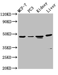 HPN / TMPRSS1 / Hepsin Antibody - Western Blot Positive WB detected in: MCF-7 whole cell lysate, PC-3 whole cell lysate, Rat kidney tissue, Mouse liver tissue All lanes: HPN antibody at 4.5µg/ml Secondary Goat polyclonal to rabbit IgG at 1/50000 dilution Predicted band size: 46 kDa Observed band size: 46 kDa