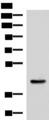 HPN / TMPRSS1 / Hepsin Antibody - Western blot analysis of Mouse liver tissue lysate  using HPN Polyclonal Antibody at dilution of 1:550