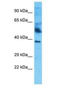 HPR Antibody - HPR antibody Western Blot of Thymus Tumor. Antibody dilution: 1 ug/ml.  This image was taken for the unconjugated form of this product. Other forms have not been tested.