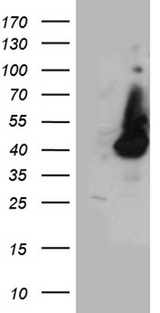 HPR Antibody - HEK293T cells were transfected with the pCMV6-ENTRY control. (Left lane) or pCMV6-ENTRY HPR. (Right lane) cDNA for 48 hrs and lysed