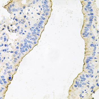 HPR Antibody - Immunohistochemistry of paraffin-embedded Mouse lung using HPR Polyclonal Antibody at dilution of 1:100 (40x lens).