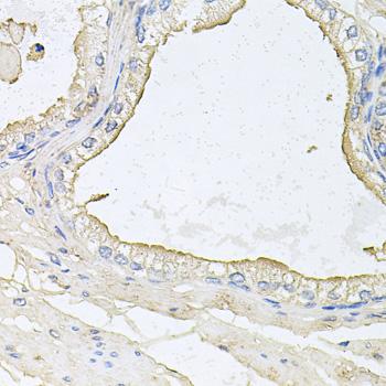 HPR Antibody - Immunohistochemistry of paraffin-embedded Human prostate using HPR Polyclonal Antibody at dilution of 1:100 (40x lens).