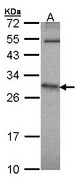 HPRT1 / HPRT Antibody - Sample (30 ug of whole cell lysate). A: IMR32 12% SDS PAGE. HPRT1 / HPRT antibody diluted at 1:1000.