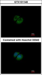 HPRT1 / HPRT Antibody - Immunofluorescence of methanol-fixed A549 using HPRT antibody at 1:500 dilution.
