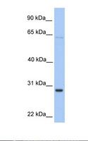 HPRT1 / HPRT Antibody - Hela cell lysate. Antibody concentration: 1.0 ug/ml. Gel concentration: 12%.  This image was taken for the unconjugated form of this product. Other forms have not been tested.