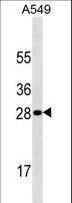 HPRT1 / HPRT Antibody - HPRT1 Antibody western blot of A549 cell line lysates (35 ug/lane). The HPRT1 antibody detected the HPRT1 protein (arrow).