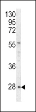 HPRT1 / HPRT Antibody - Western blot of HPRT1 antibody in HeLa cell line lysates (35 ug/lane). HPRT1 (arrow) was detected using the purified antibody.