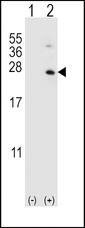 HPRT1 / HPRT Antibody - Western blot of HPRT1 (arrow) using rabbit polyclonal HPRT1 Antibody. 293 cell lysates (2 ug/lane) either nontransfected (Lane 1) or transiently transfected (Lane 2) with the HPRT1 gene.