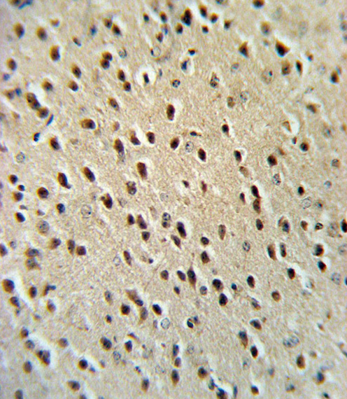 HPRT1 / HPRT Antibody - HPRT1 Antibody IHC of formalin-fixed and paraffin-embedded mouse brain tissue followed by peroxidase-conjugated secondary antibody and DAB staining.