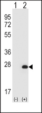 HPRT1 / HPRT Antibody - Western blot of HPRT1 (arrow) using rabbit polyclonal HPRT1 Antibody. 293 cell lysates (2 ug/lane) either nontransfected (Lane 1) or transiently transfected (Lane 2) with the HPRT1 gene.