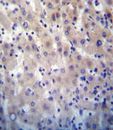 HPRT1 / HPRT Antibody - HPRT1 Antibody immunohistochemistry of formalin-fixed and paraffin-embedded human liver tissue followed by peroxidase-conjugated secondary antibody and DAB staining.