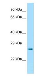 HPRT1 / HPRT Antibody - HPRT1 / HPRT antibody Western Blot of Mouse Thymus.  This image was taken for the unconjugated form of this product. Other forms have not been tested.