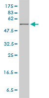 HPRT1 / HPRT Antibody - HPRT1 monoclonal antibody (M01), clone 4C3-G8 Western Blot analysis of HPRT1 expression in MCF-7.