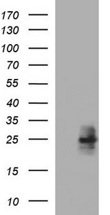 HPRT1 / HPRT Antibody - HEK293T cells were transfected with the pCMV6-ENTRY control (Left lane) or pCMV6-ENTRY HPRT1 (Right lane) cDNA for 48 hrs and lysed. Equivalent amounts of cell lysates (5 ug per lane) were separated by SDS-PAGE and immunoblotted with anti-HPRT1.