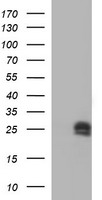 HPRT1 / HPRT Antibody - HEK293T cells were transfected with the pCMV6-ENTRY control (Left lane) or pCMV6-ENTRY HPRT1 (Right lane) cDNA for 48 hrs and lysed. Equivalent amounts of cell lysates (5 ug per lane) were separated by SDS-PAGE and immunoblotted with anti-HPRT1.
