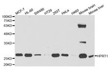 HPRT1 / HPRT Antibody - Western blot analysis of extracts of various cell lines.