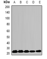 HPRT1 / HPRT Antibody - Western blot analysis of HPRT expression in SW480 (A); HT29 (B); HeLa (C); mouse brain (D); mouse liver (E) whole cell lysates.