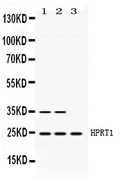 HPRT1 / HPRT Antibody - Western blot - Anti-HPRT Picoband Antibody
