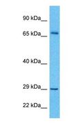 HPS / HPS1 Antibody - Western blot of HPS1 Antibody with human HeLa Whole Cell lysate.  This image was taken for the unconjugated form of this product. Other forms have not been tested.