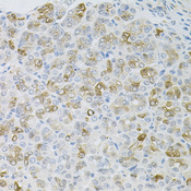 HPS / HPS1 Antibody - Immunohistochemistry of paraffin-embedded mouse stomach tissue.