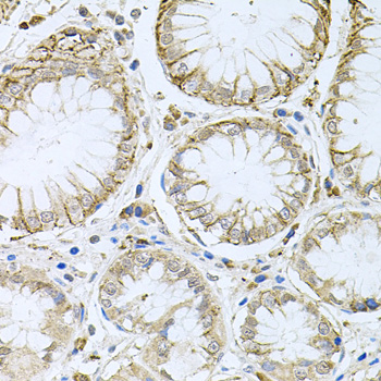 HPS / HPS1 Antibody - Immunohistochemistry of paraffin-embedded human stomach tissue.