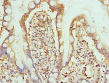 HPS / HPS1 Antibody - Immunohistochemistry of paraffin-embedded human small intestine at dilution 1:100